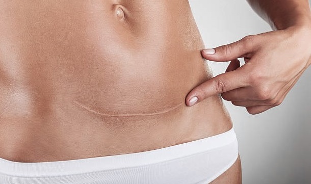 best normal cesarean delivery specialist in mumbai