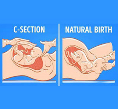 Serivce Image