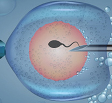 Serivce Image